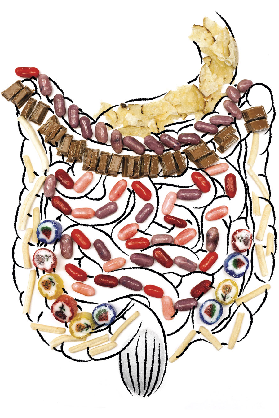 El intestino enfermo Rodrigo Hurtado